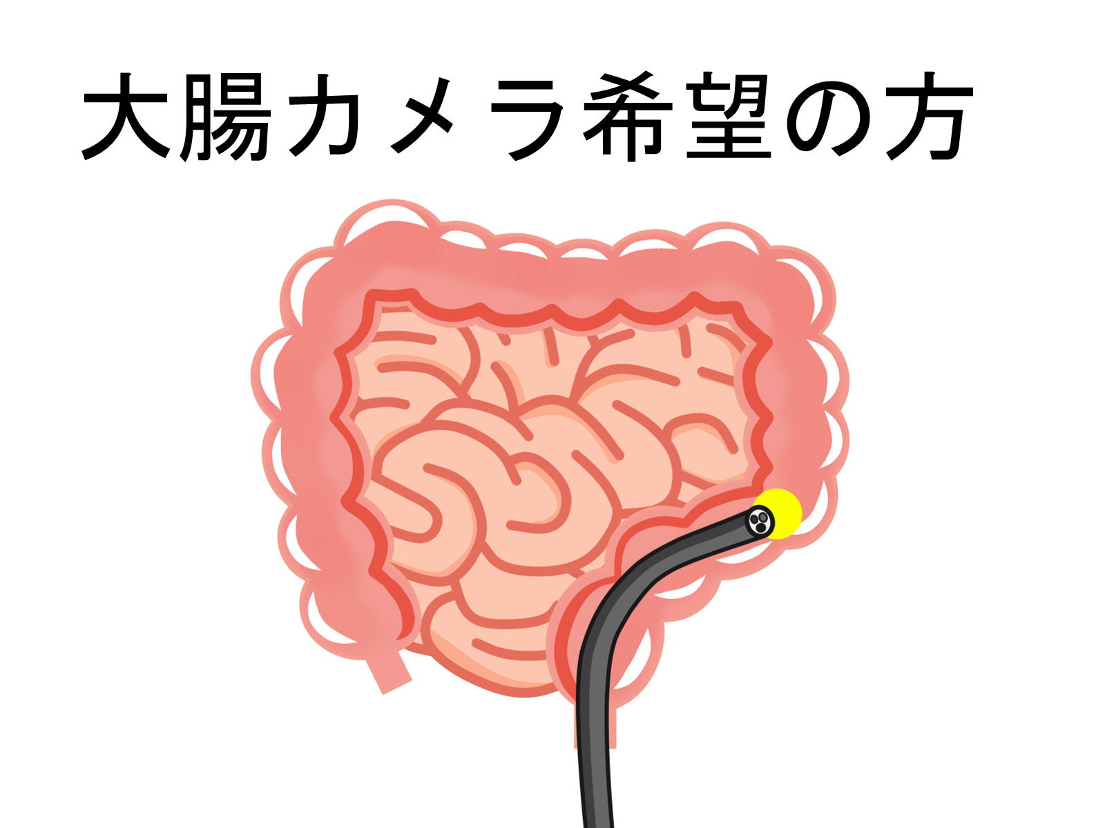 横須賀　石橋クリニック　大腸カメラ　内視鏡検査