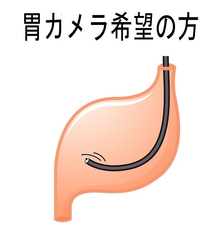 横須賀　石橋クリニック　胃カメラ　内視鏡検査